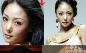 十大韩国整容失败明星，十大韩国整容失败明星是谁